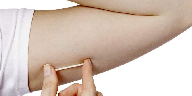 Contraceptive Implants