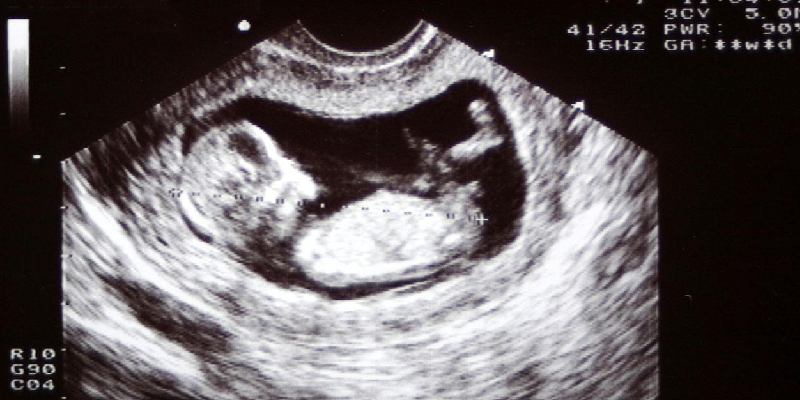 Pregnancy Ultrasound Report Guide
