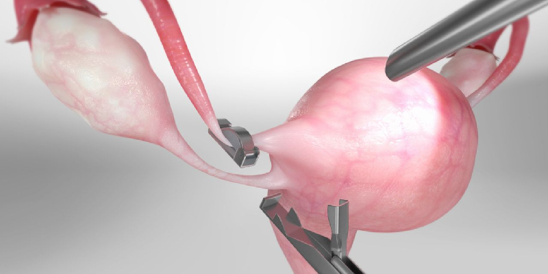 Vomiting During Pregnancy