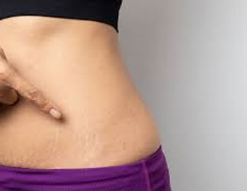 Fibroid surgery without big cut