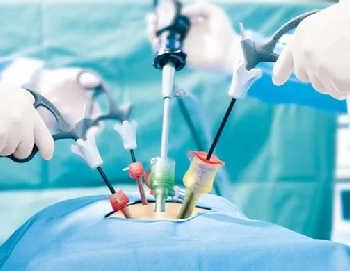 ⁠⁠Laparoscopy for Ovarian Cysts