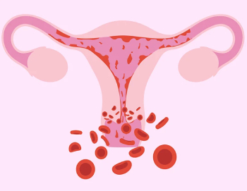 ⁠heavy menstrual bleeding