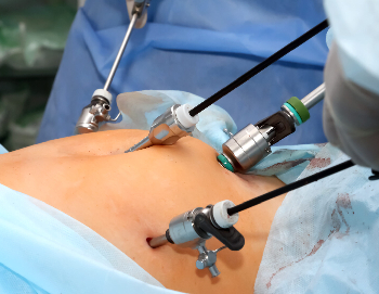 Burnout is Not Laziness